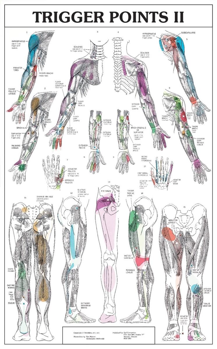 Trigger Points Chart 2 Parts Soft Lamination Prime Trigger Points Chart TP1L 85 00 Prime Alternatives Massage Tables Australia