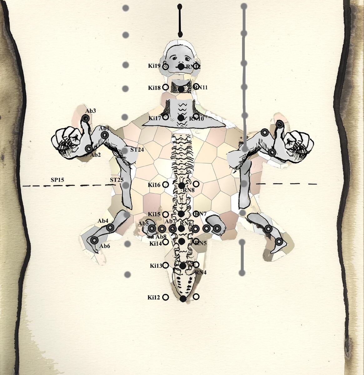 Abdominal Acupuncture A Case History Dantien Accupuncture