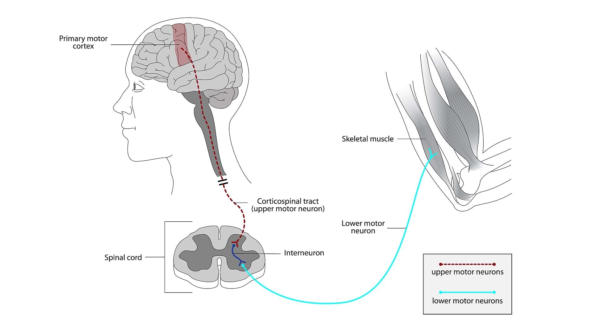 Decoding Muscle Movement Analyzing Neuromuscular Signals With EMG Activity TeachEngineering